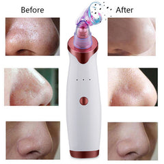 Cleaner Skin Care Facial Pore Cleaner Machine